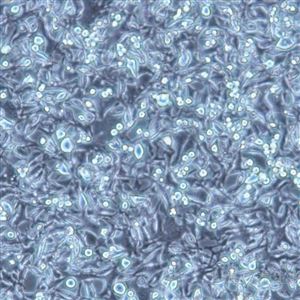 BT357MB49小鼠膀胱癌细胞T25